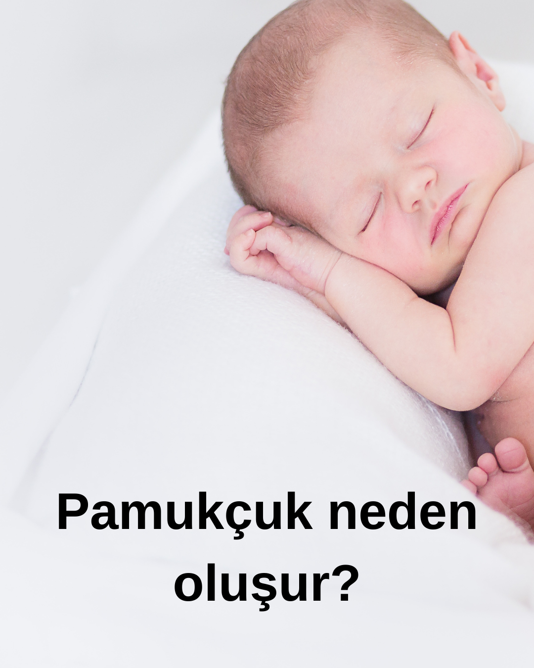 Yenidoğan bebeklerin ağzında oluşan pamukcuklar